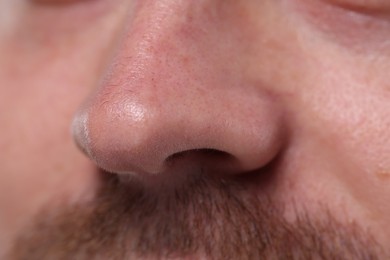 Photo of Closeup view of man with normal skin