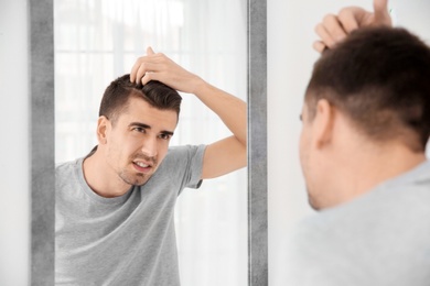 Young man with hair loss problem looking in mirror indoors