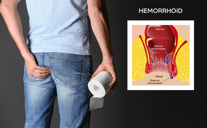 Man with toilet paper suffering from hemorrhoid pain on black background, closeup. Illustration of unhealthy lower rectum