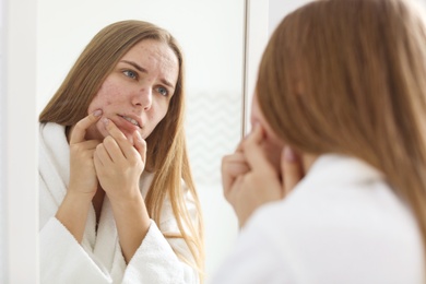 Young woman with acne problem near mirror in bathroom