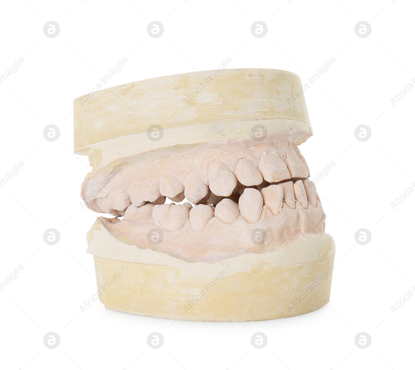 Photo of Dental model with jaws isolated on white. Cast of teeth