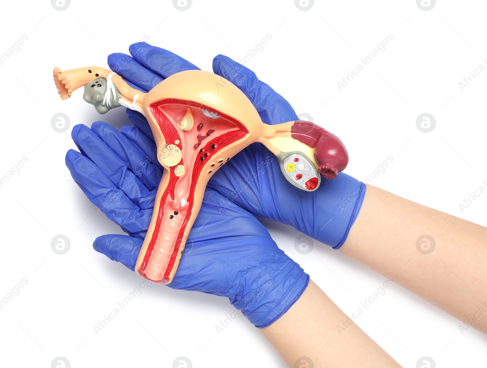 Photo of Woman holding model of female reproductive system on white background, top view. Gynecological care