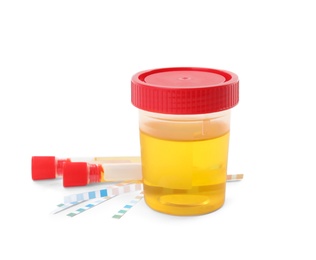 Photo of Laboratory ware with urine samples for analysis on white background