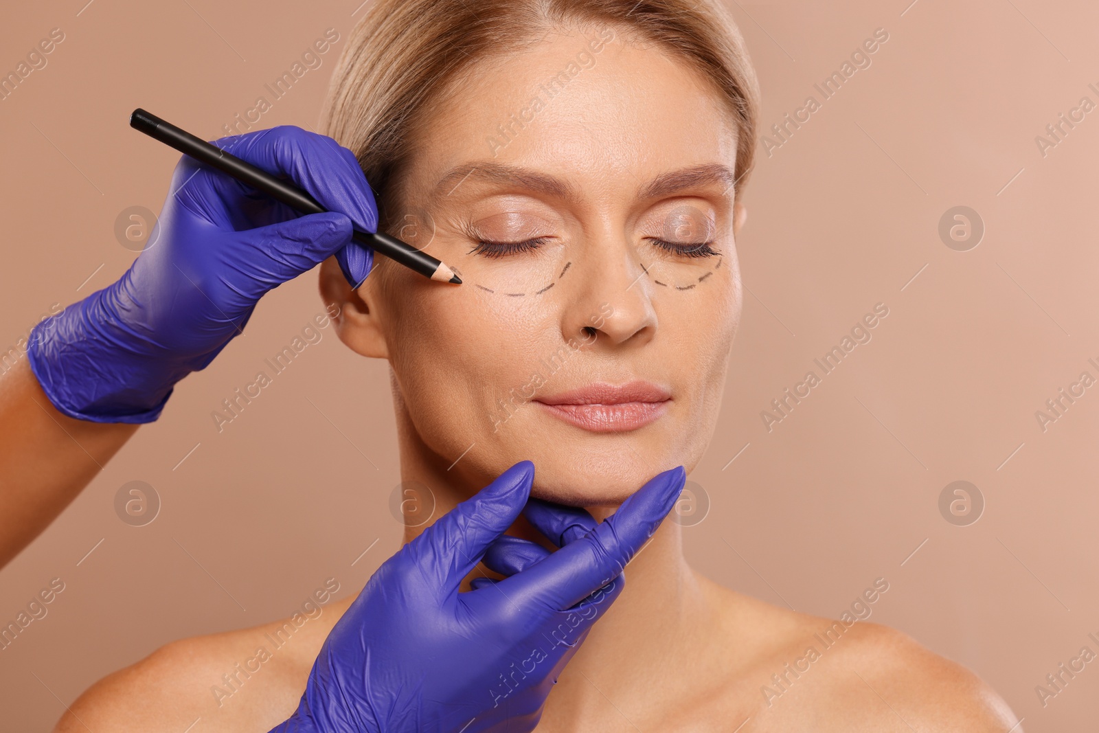 Photo of Doctor with pencil preparing patient for cosmetic surgery operation on light brown background, closeup