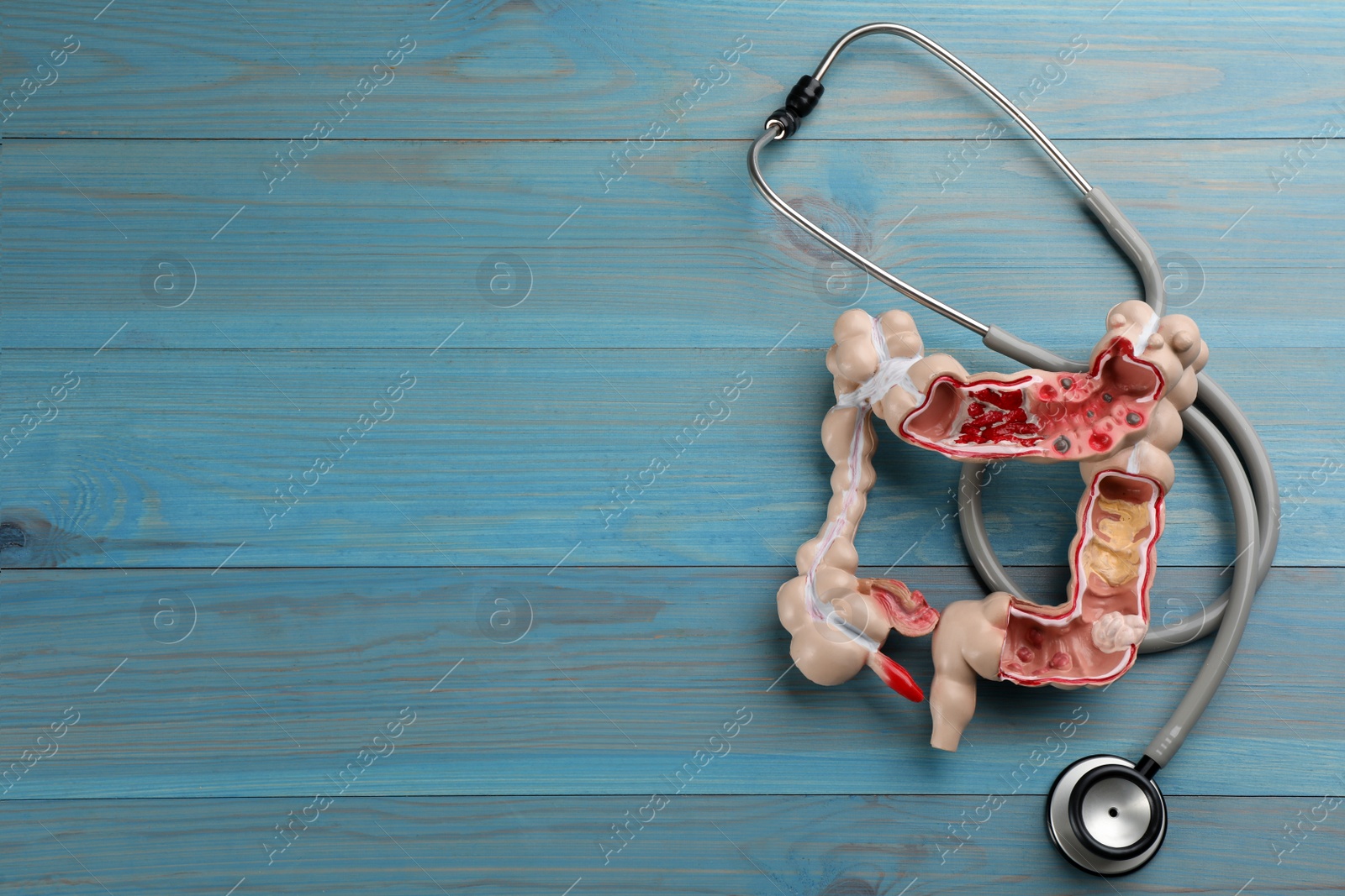 Photo of Human colon model and stethoscope on light blue wooden table, flat lay. Space for text