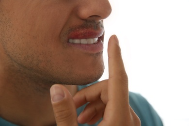 Photo of Man with herpes touching lips against light background, closeup