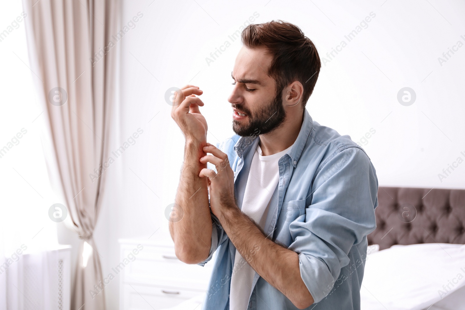 Photo of Young man scratching hand indoors, space for text. Allergies symptoms