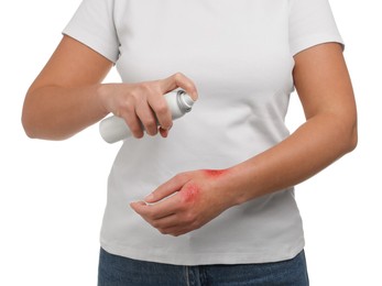 Photo of Woman applying panthenol onto burned hand on white background, closeup