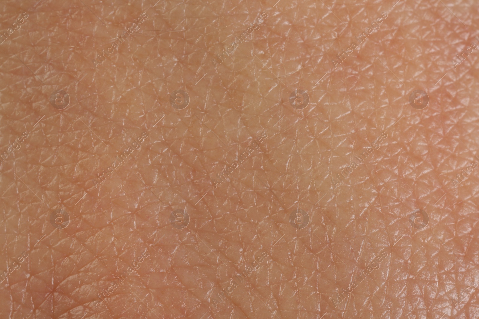 Photo of Texture of healthy skin as background, macro view