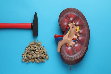Model of kidneys with stones and hammer on light blue background, flat lay