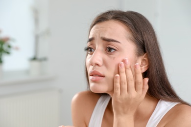 Photo of Young woman with eyelash loss problem indoors