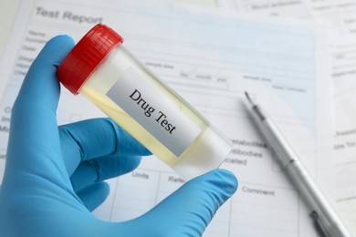 Photo of Drug test. Laboratory worker holding container with urine sample over medical form on table, closeup