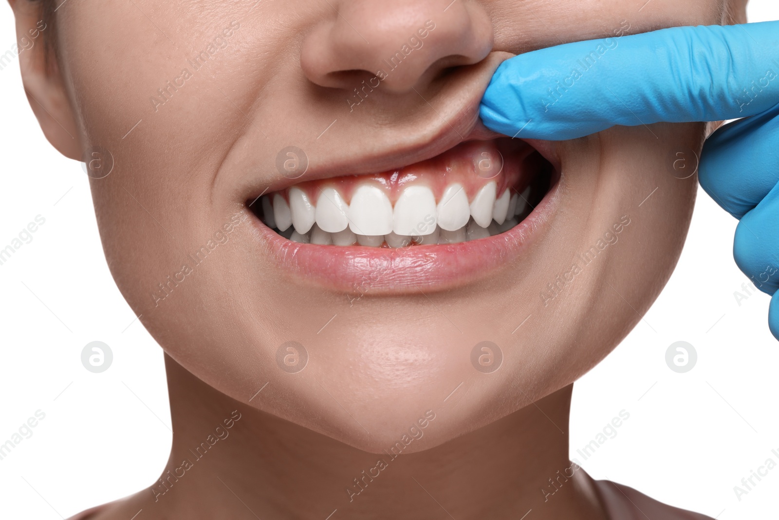 Photo of Woman showing healthy gums on white background, closeup