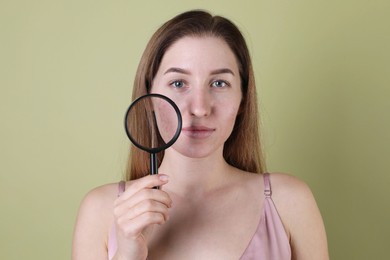 Photo of Young woman with acne problem holding magnifying glass near her skin on olive background