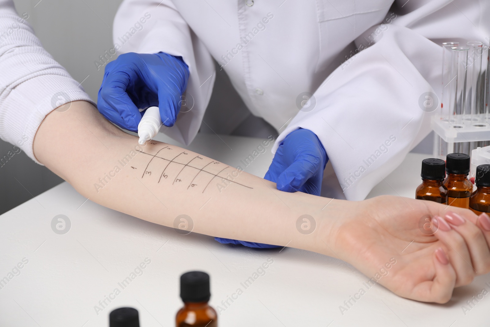 Photo of Doctor doing skin allergy test at light table, closeup