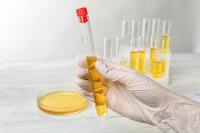 Laboratory worker holding test tube with urine sample near table, closeup. Urology concept