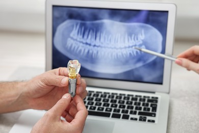 Photo of Doctor showing patient X-ray picture and educational model of dental implant in clinic, closeup