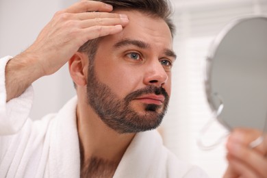 Photo of Man with skin problem looking at mirror indoors