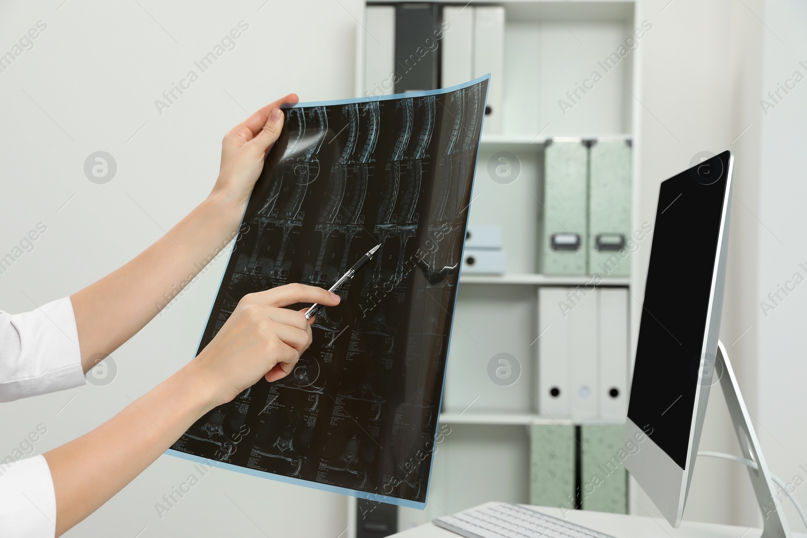 Photo of Doctor examining neck MRI image in clinic, closeup