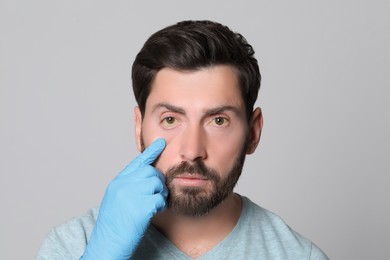 Doctor checking man with yellow eyes on grey background. Symptom of hepatitis