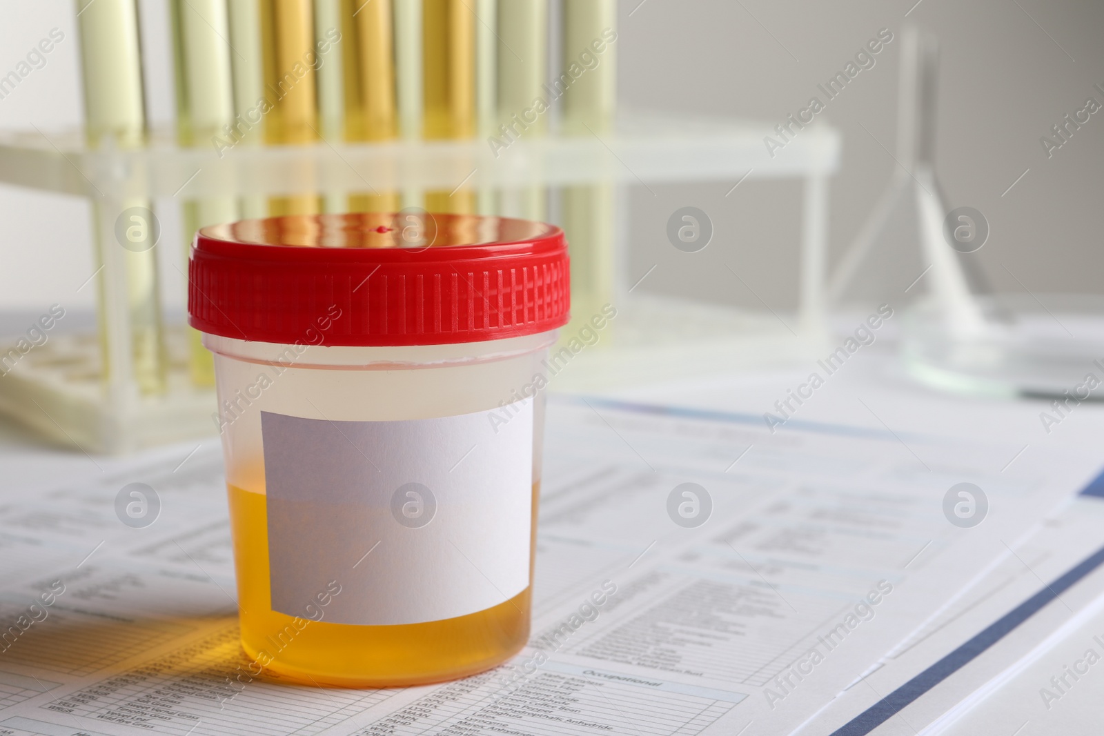 Photo of Container with urine sample on table, closeup. Space for text