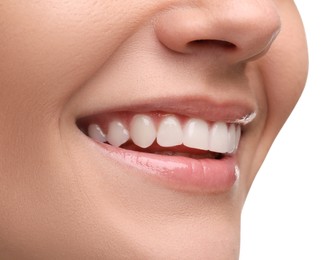 Woman with clean teeth smiling on white background, closeup