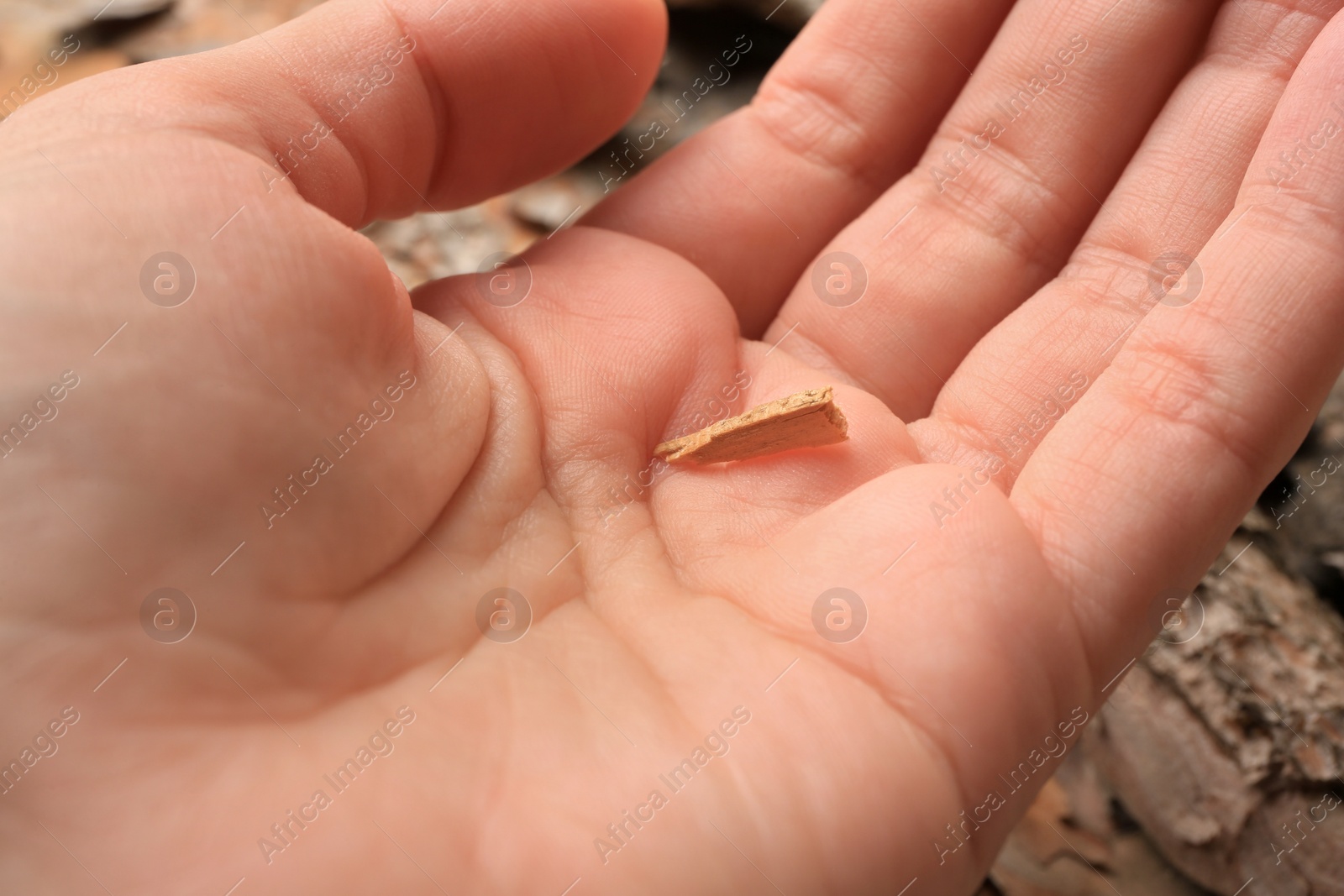 Photo of Woman with splinter in her hand outdoors, closeup