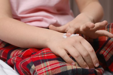 Little girl applying ointment onto her hand at home, closeup