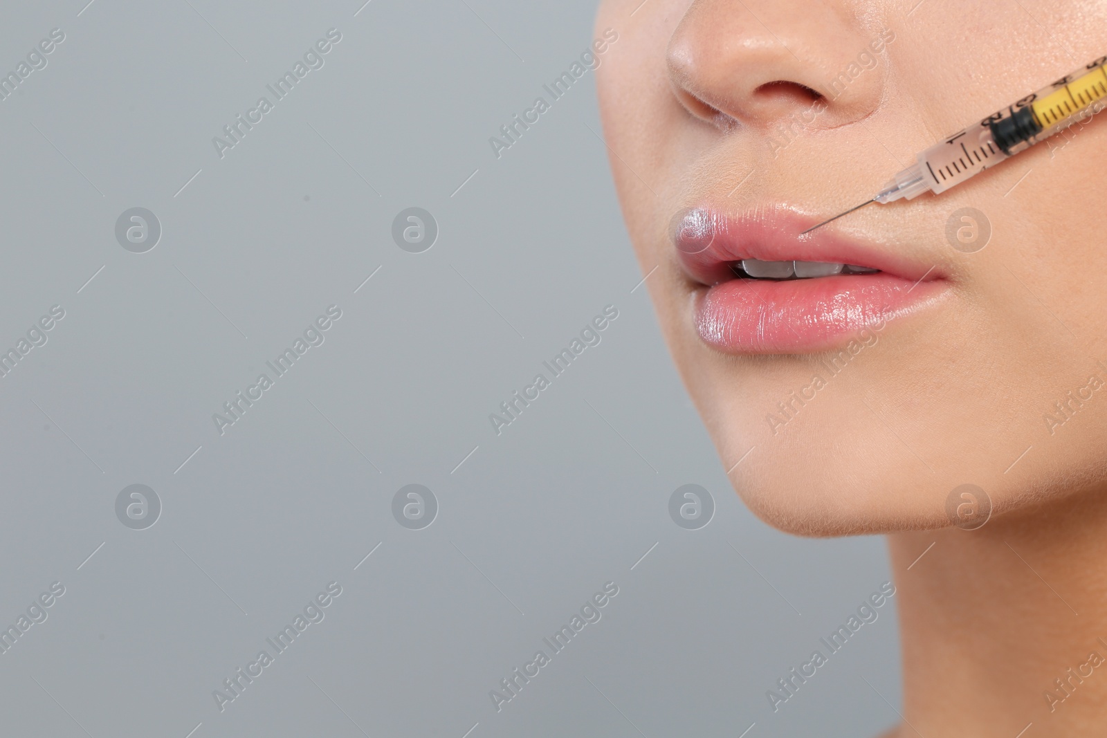 Photo of Young woman getting lips injection on grey background, space for text. Cosmetic surgery