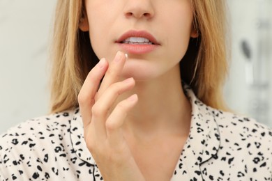 Photo of Woman with herpes applying cream onto lip against blurred background, closeup