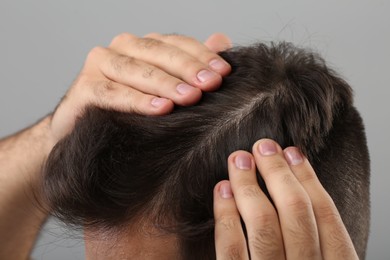 Photo of Man examining his head on light grey background, closeup. Dandruff problem