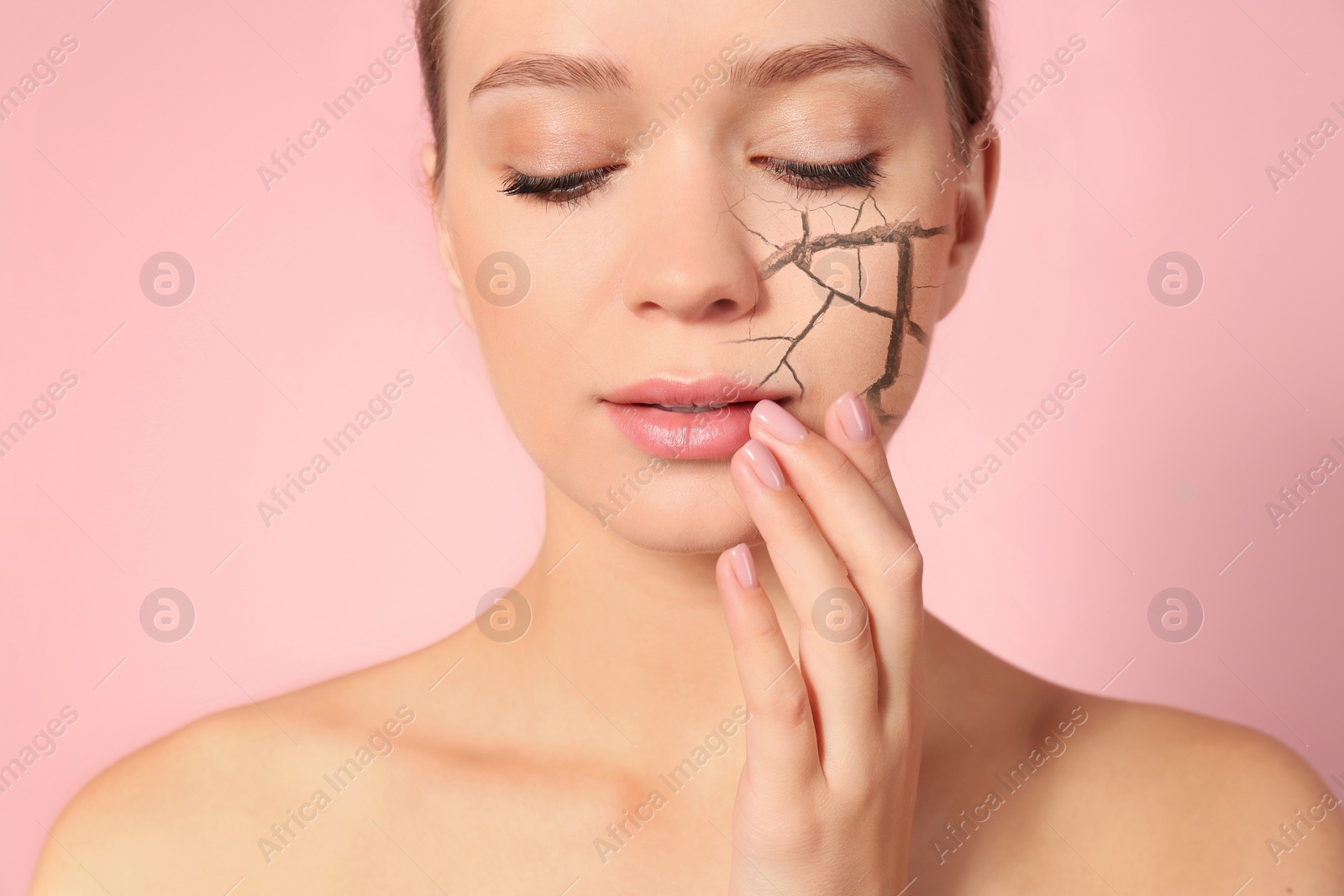 Image of Beautiful young woman with dry skin on pink background, closeup