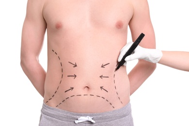 Doctor drawing lines on man's stomach with marker against white background