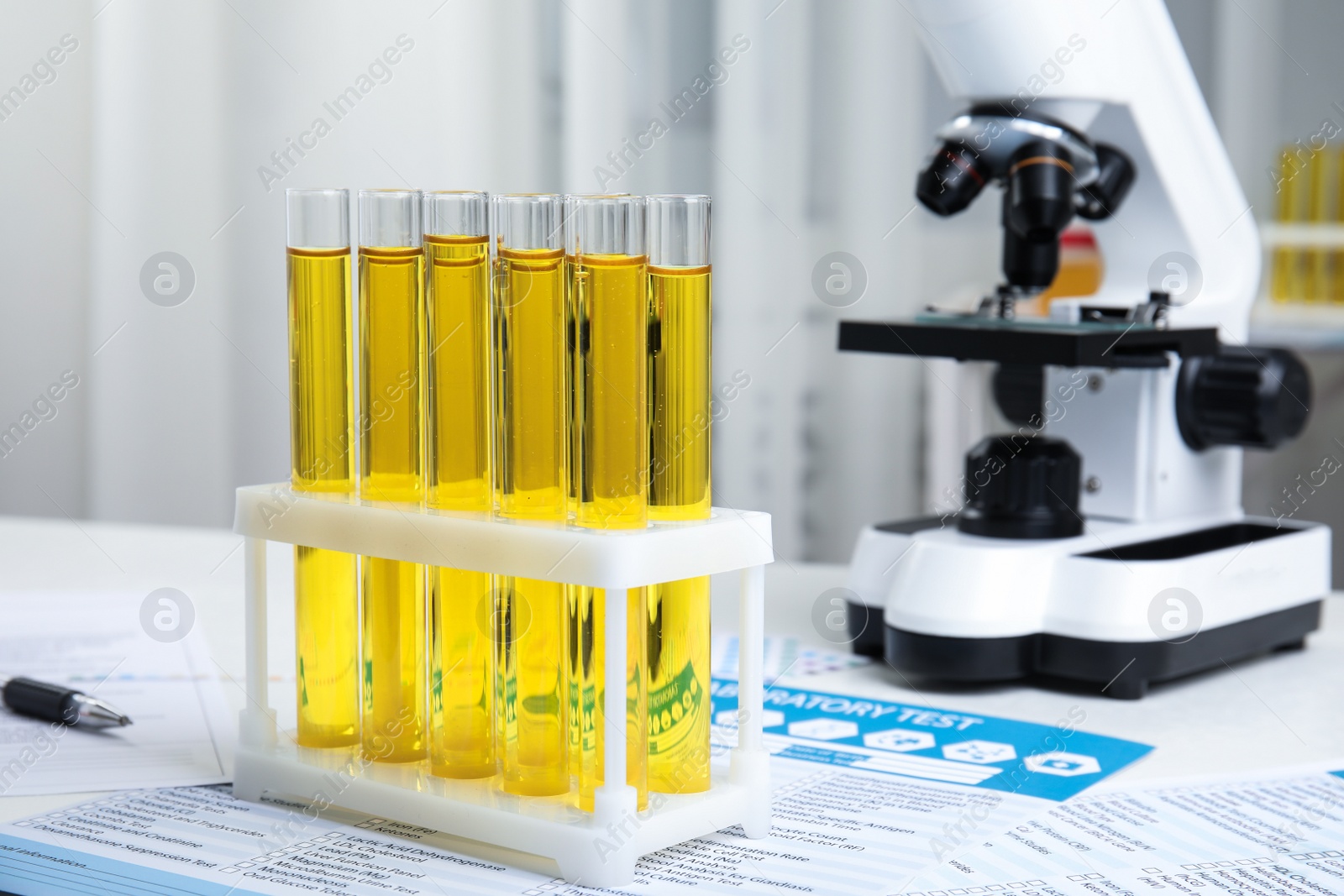 Photo of Test tubes with urine samples for analysis on white table in laboratory