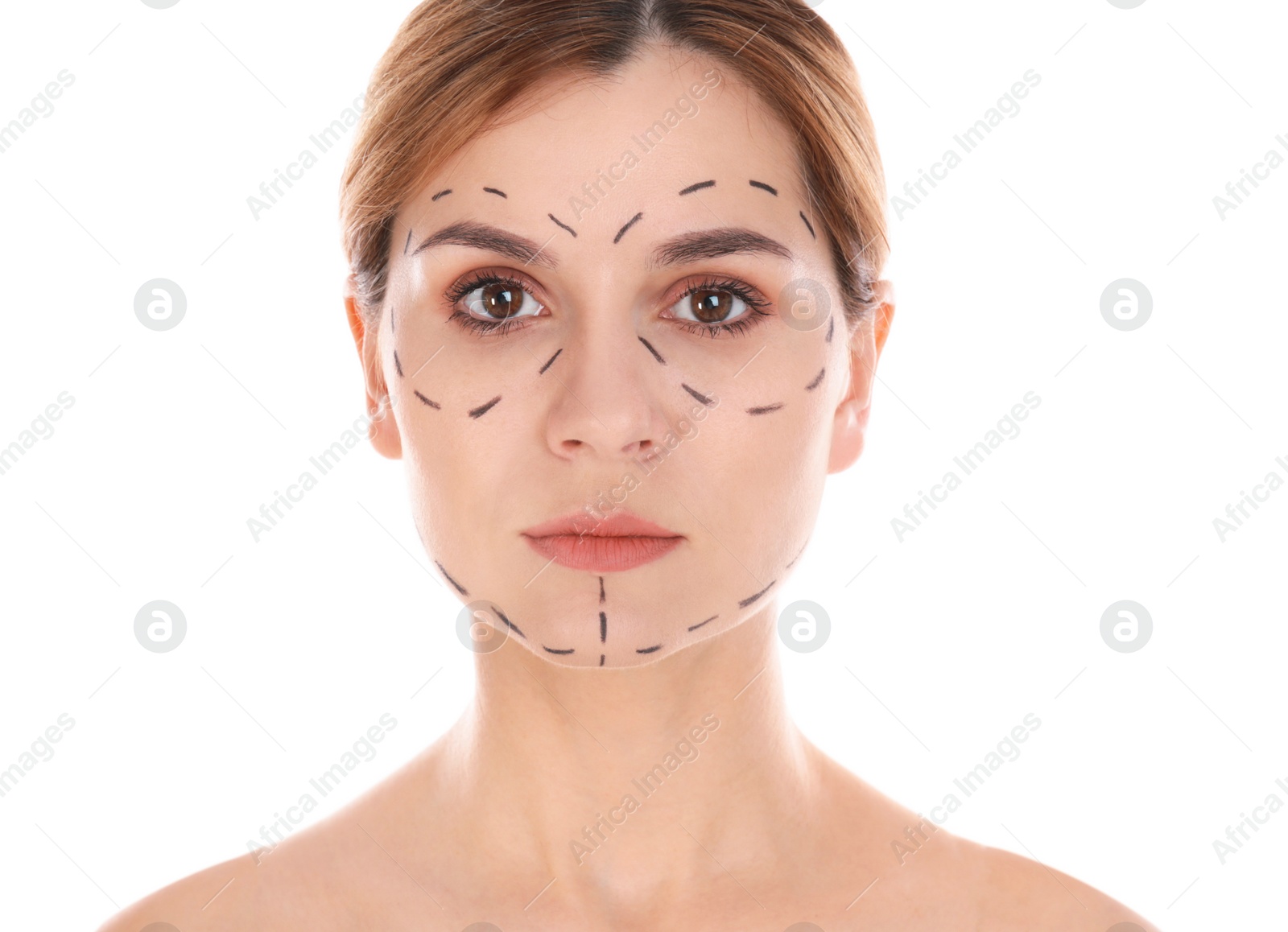 Photo of Portrait of woman with marks on face for cosmetic surgery operation against white background