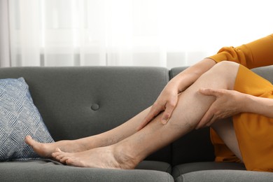 Photo of Barefoot woman with varicose veins resting on sofa in room, closeup