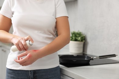 Photo of Woman applying panthenol onto burns on her hand in kitchen, closeup. Space for text