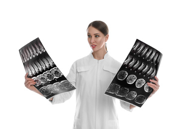 Orthopedist holding X-ray pictures on white background