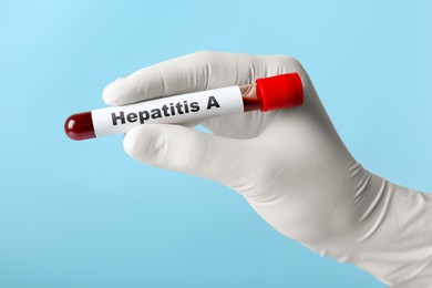 Scientist holding tube with blood sample and label Hepatitis A on light blue background, closeup