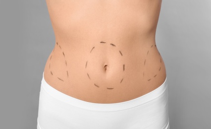 Young woman with marks on body for cosmetic surgery operation against grey background, closeup