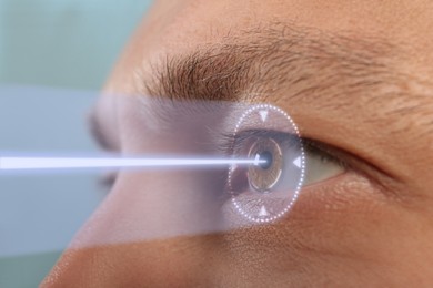 Image of Closeup view of man and mark illustration on his eye. Vision correction surgery
