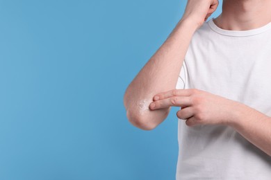 Photo of Man applying ointment onto his elbow on light blue background, closeup. Space for text