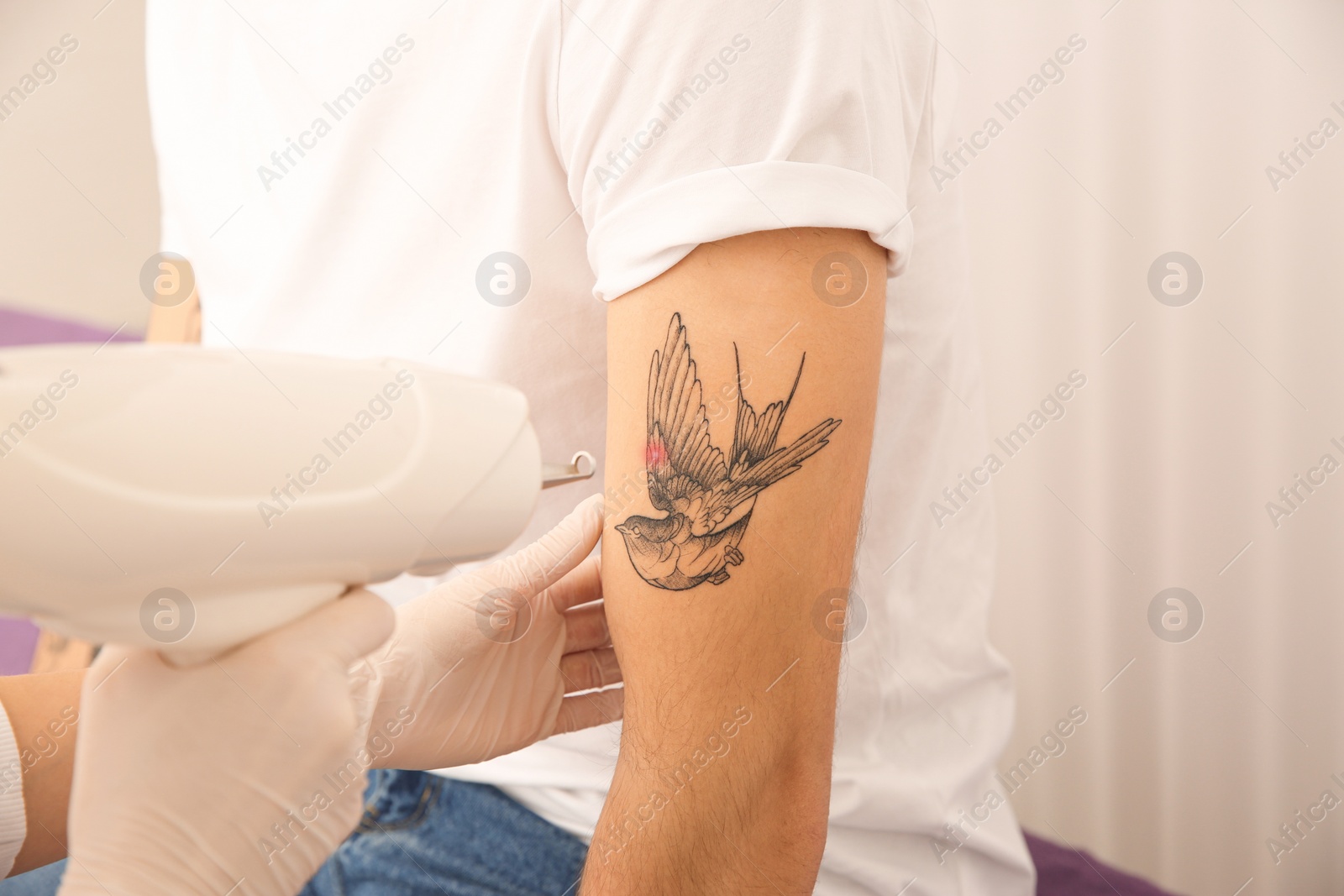 Photo of Young man undergoing laser tattoo removal procedure in salon, closeup