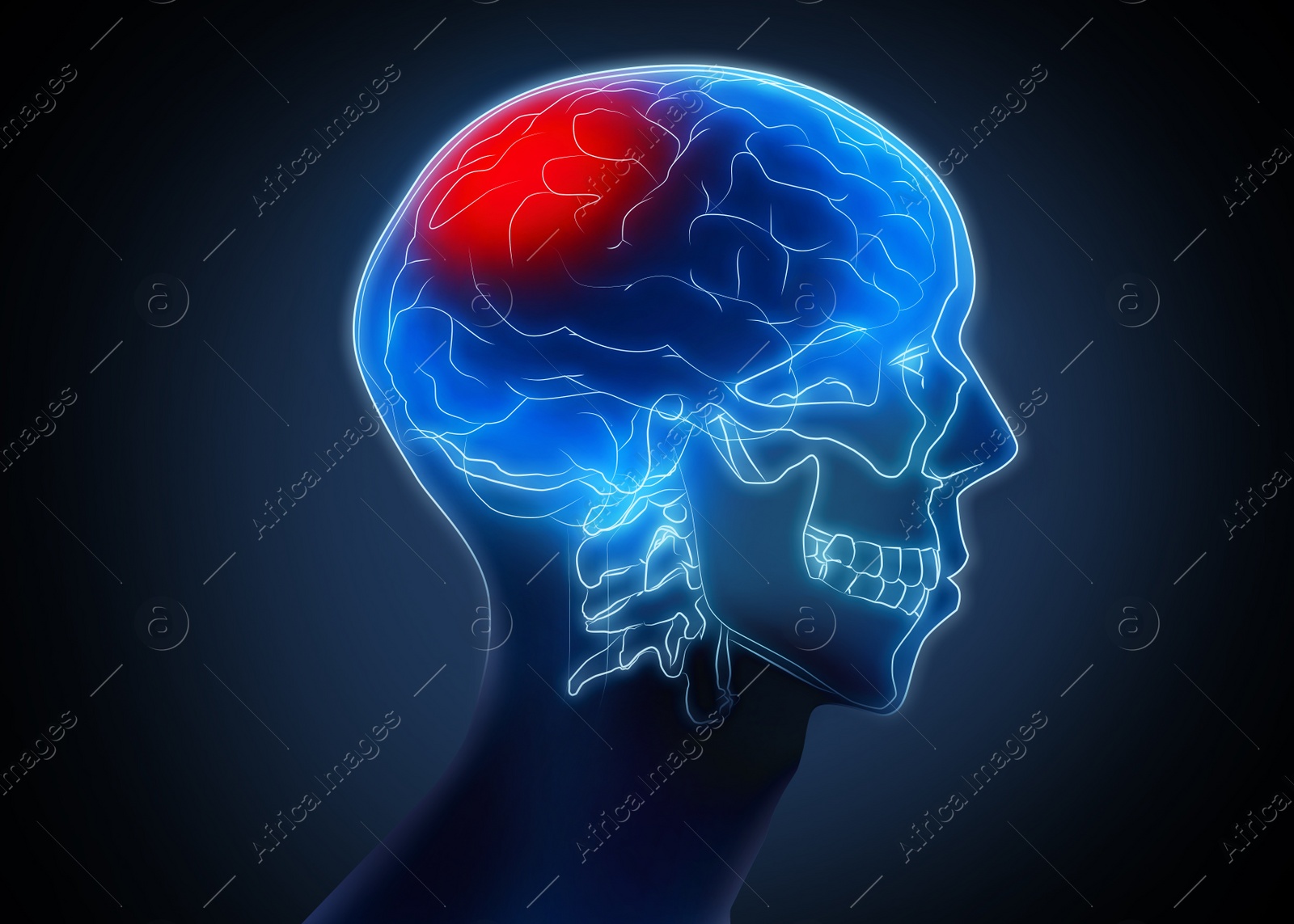 Illustration of Scan of human brain with injured area on dark background, illustration