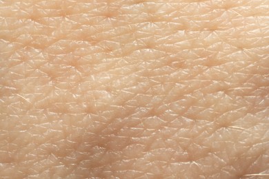 Photo of Texture of dry skin as background, macro view