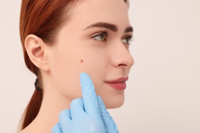 Dermatologist examining patient's birthmark on beige background, closeup