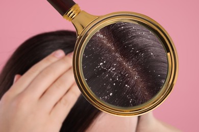 Image of Woman suffering from dandruff on pink background, closeup. View through magnifying glass on hair with flakes