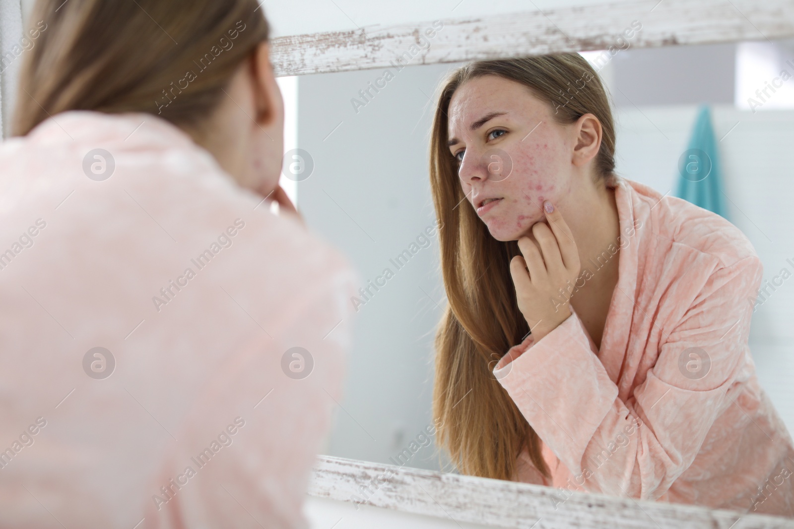 Photo of Young woman with acne problem near mirror in bathroom