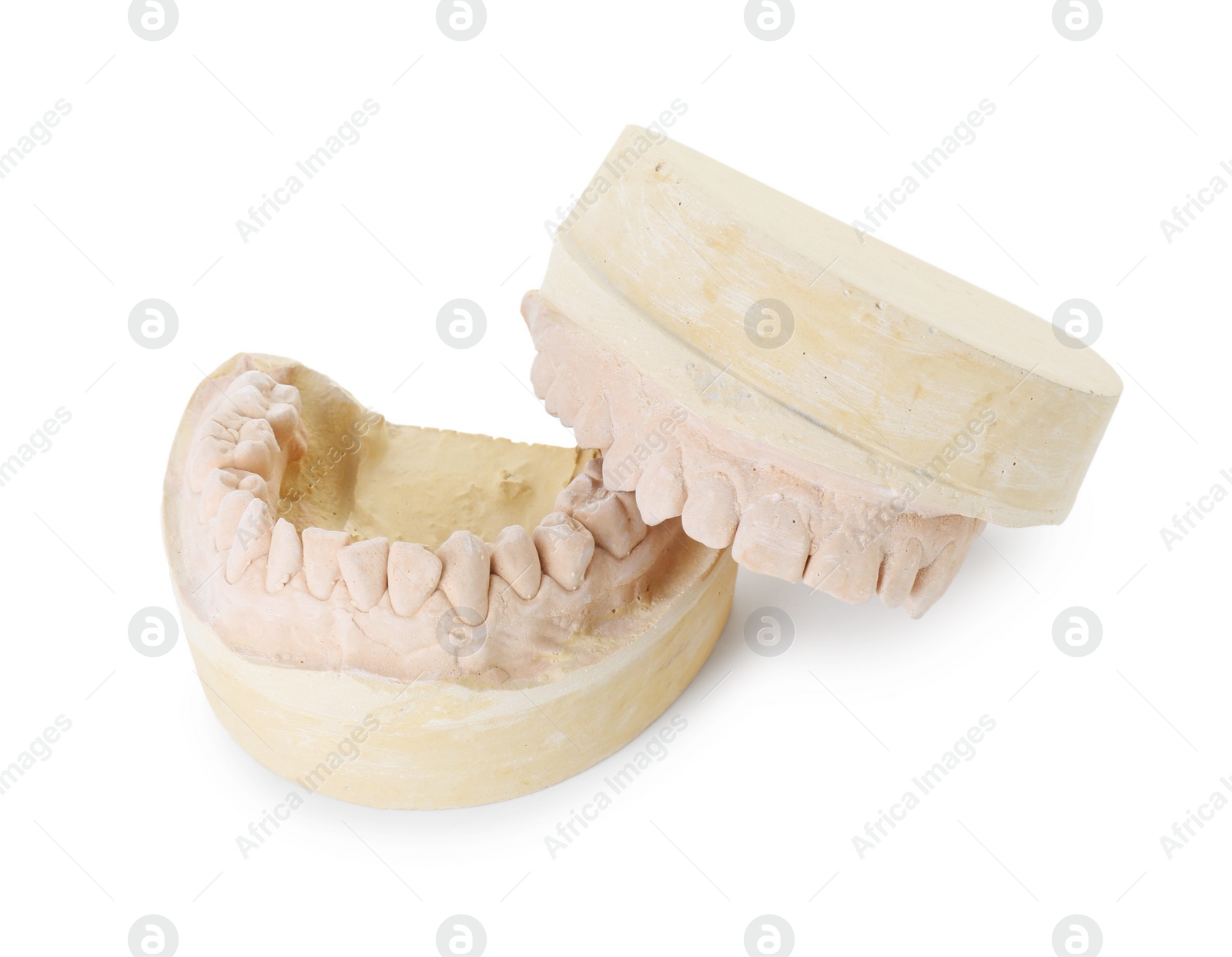 Photo of Dental model with jaws isolated on white. Cast of teeth