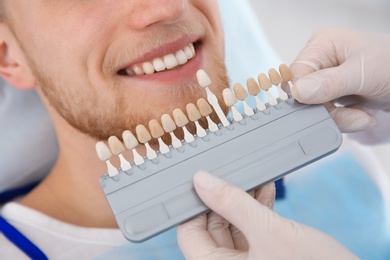 Photo of Dentist selecting patient's teeth color with palette in clinic, closeup